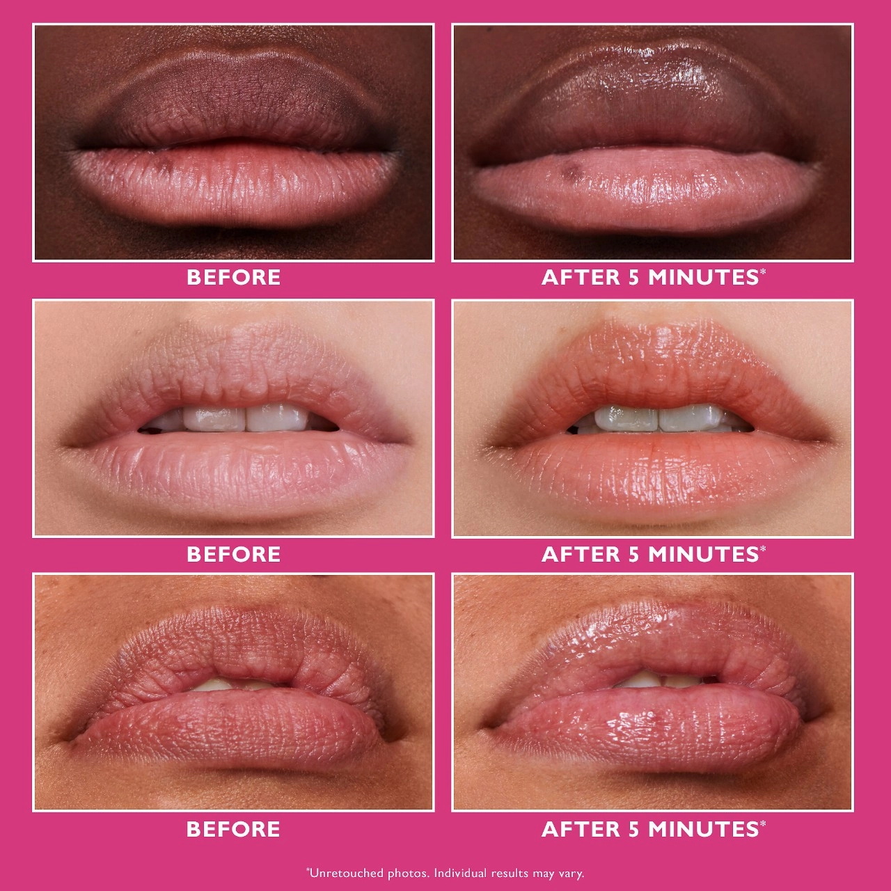 Peter Thomas Roth Instant FIRMx® Lip Filler - Plumping Hyaluronic Acid - 0.3 fl oz / 10 mL - Image 4